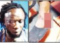 Ebonyi singer beaten to a pulp over campaign song