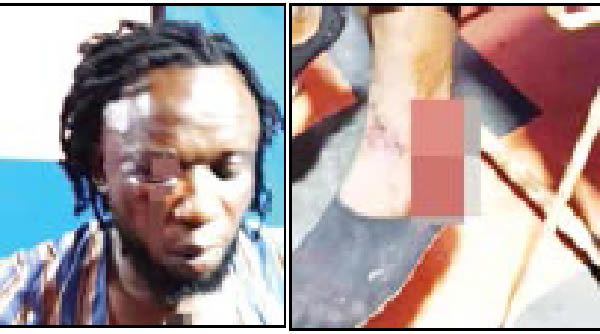 Ebonyi singer beaten to a pulp over campaign song